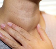 Struma štitnjače (guša)