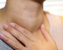 Asian,Lady,Woman,Patient,Have,Abnormal,Enlargement,Of,Thyroid,Gland