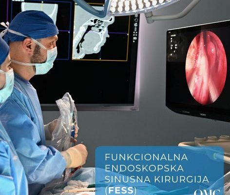 Endoskopska operacija sinusa (FESS) u Zagrebu – Trajno rješenje za kronični sinusitis | QMC