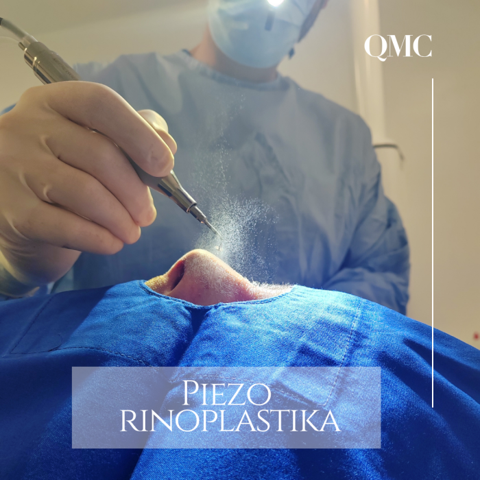 Piezo rinoplastika - QMC