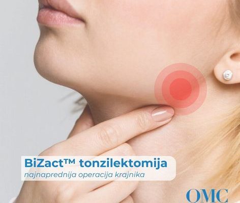 Tonzilektomija – operacija krajnika s Bizact™ uređajem | Operacija krajnika Zagreb | QMC
