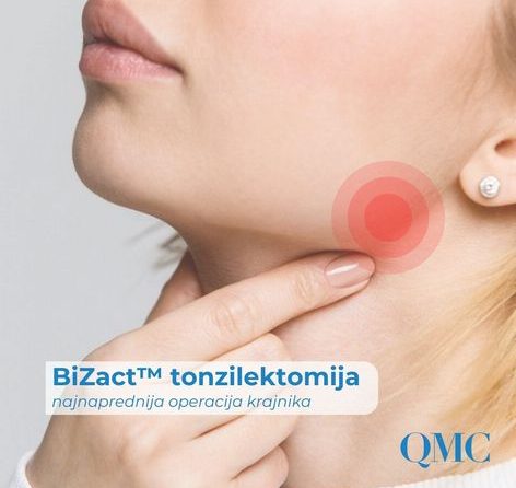 Tonzilektomija – operacija krajnika s Bizact™ uređajem  | Operacija krajnika Zagreb | QMC