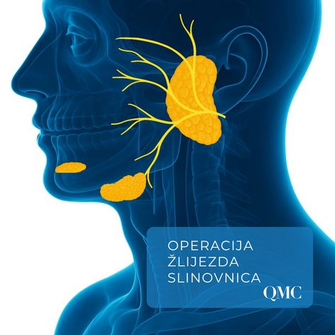 operacija žlijezda slinovnica