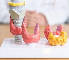 Tumori štitnjače (benigni i maligni)