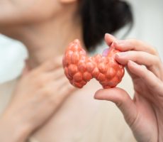 Hashimoto tireoditis i ostale upalne bolesti štitnjače (tireoditisi)