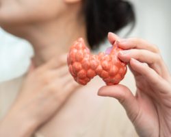 Hyperthyroidism,,Overactive,Thyroid,,Thyroid,Lymphoma,,Asian,Woman,With,Thyroid,Gland