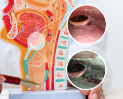 Narrow Band Imaging (NBI) prikaz grkljana i ždrijela uz anatomski model glave i vrata