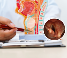 Model grkljana i endoskopski prikaz pareze glasnice