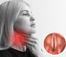 Žena drži vrat zbog bolova u grlu, prikaz upaljenih glasnica povezanih s promuklošću
