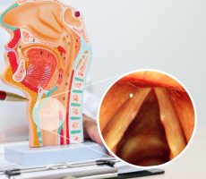 Medicinski model grkljana s uvećanim prikazom vokalnih čvorova na glasnicama