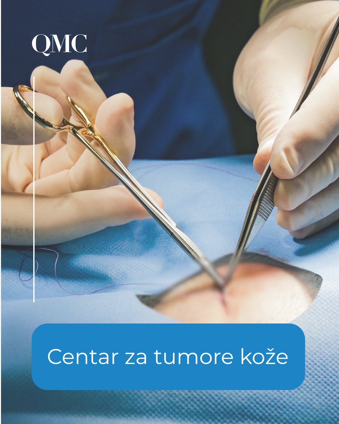 Centar za tumore kože