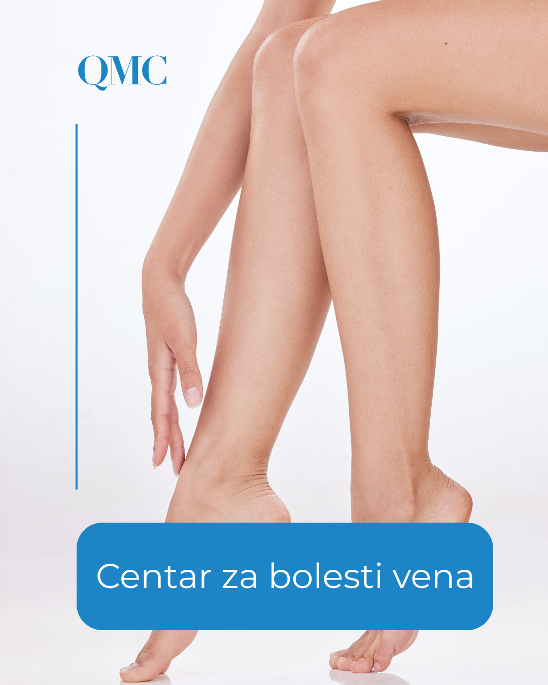 Centar za bolesti vena