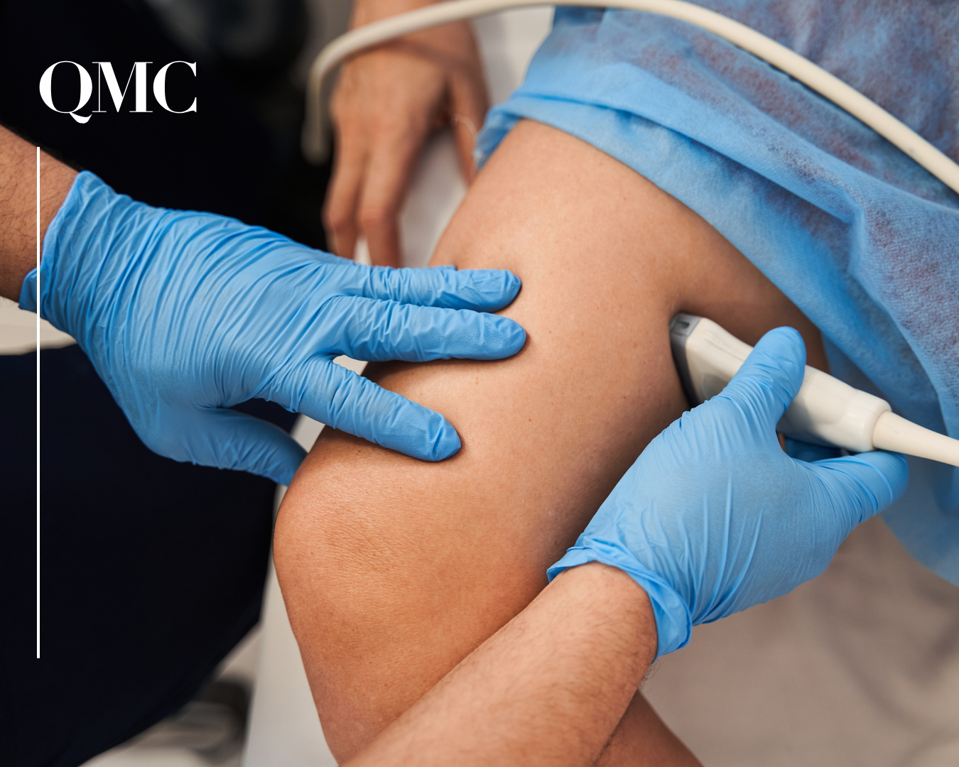 Pregled vaskularnog kirurga