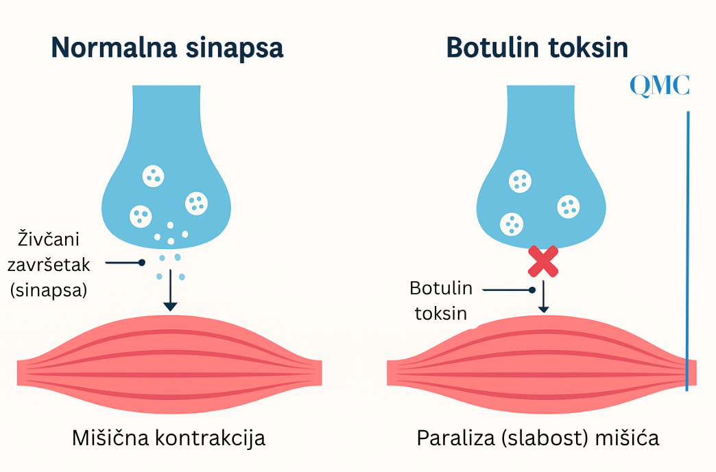 Djelovanje (botoxa) na živčane završetke