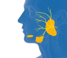 Žlijezde slinovnice - tumori