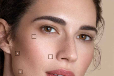 Profhilo za lice, vrat i tijelo