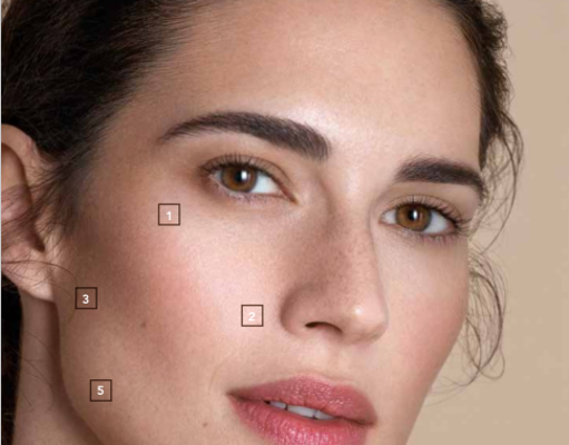 Profhilo za lice, vrat i tijelo